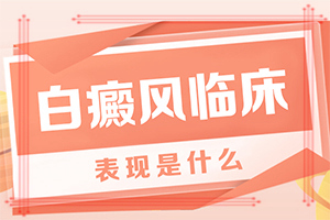 白顛瘋病可以根治嗎[有哪些方法可以緩解]兒童白癩癜風(fēng)能治好嗎
