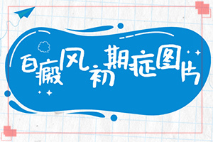 [如何正確診療時間]白癲瘋能治療嗎