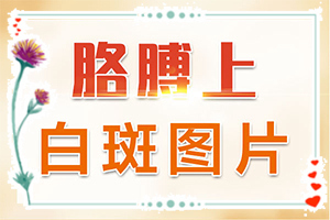 怎么白癲瘋是怎得上的,哪些因素導(dǎo)致(誘發(fā)的原因有)