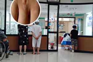 威靈仙泡酒治療白癜風(fēng)